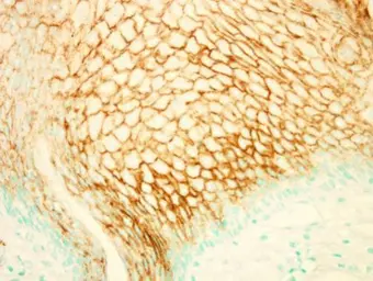 Anti-PI3 kinase p101 antibody [C2C3-2], C-term used in IHC (Paraffin sections) (IHC-P). GTX107813